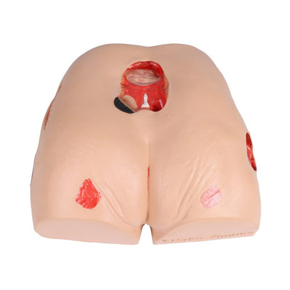 DECUBITUS DAN Treatment Simulator