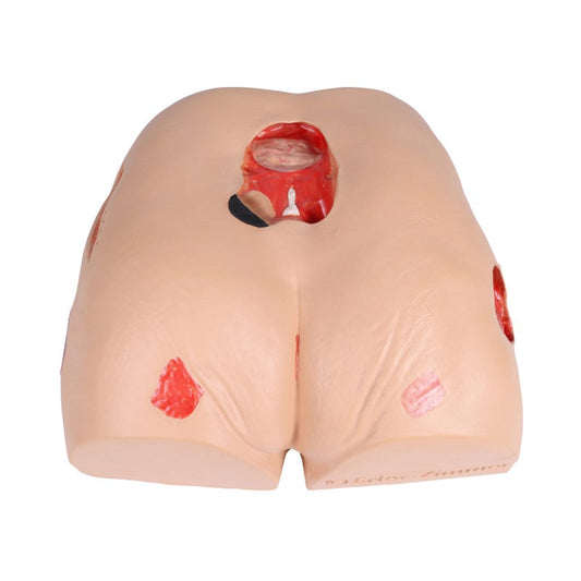 DECUBITUS DAN Treatment Simulator