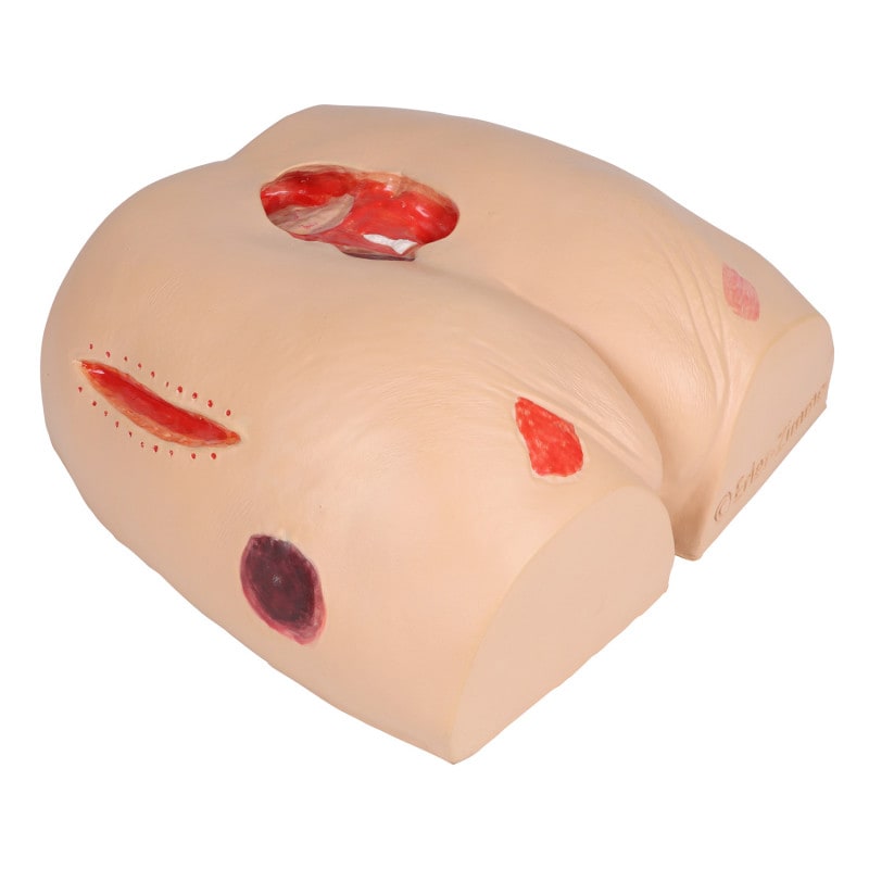 DECUBITUS DAN Treatment Simulator