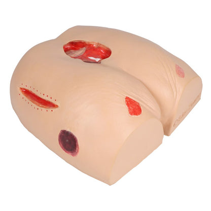 DECUBITUS DAN Treatment Simulator