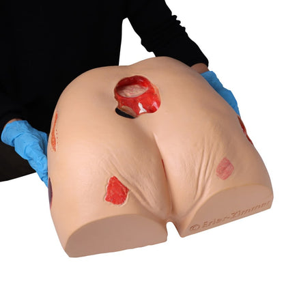 DECUBITUS DAN Treatment Simulator
