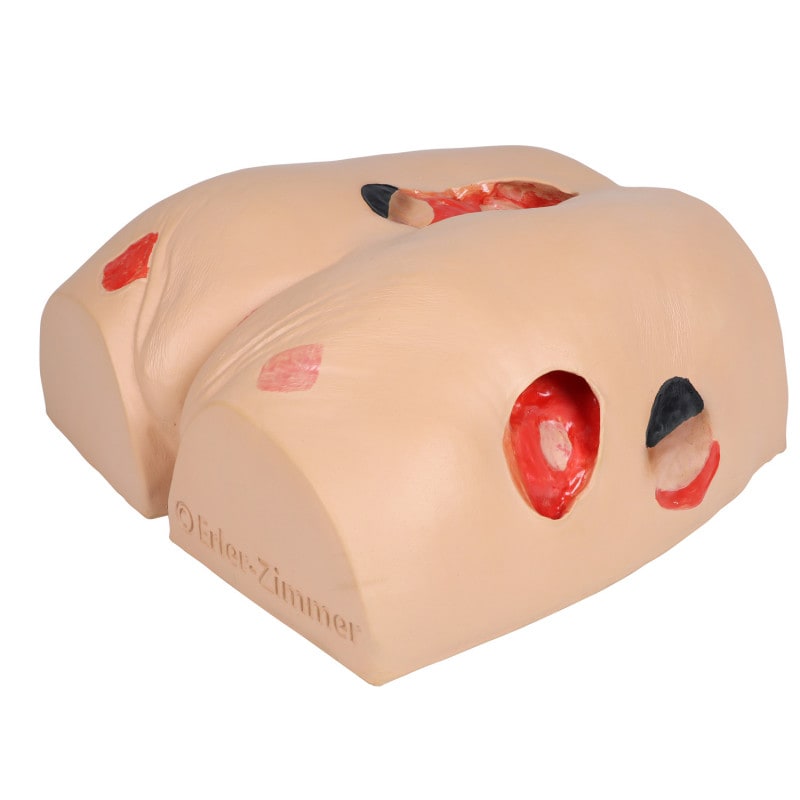 DECUBITUS DAN Treatment Simulator