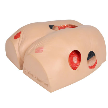 DECUBITUS DAN Treatment Simulator