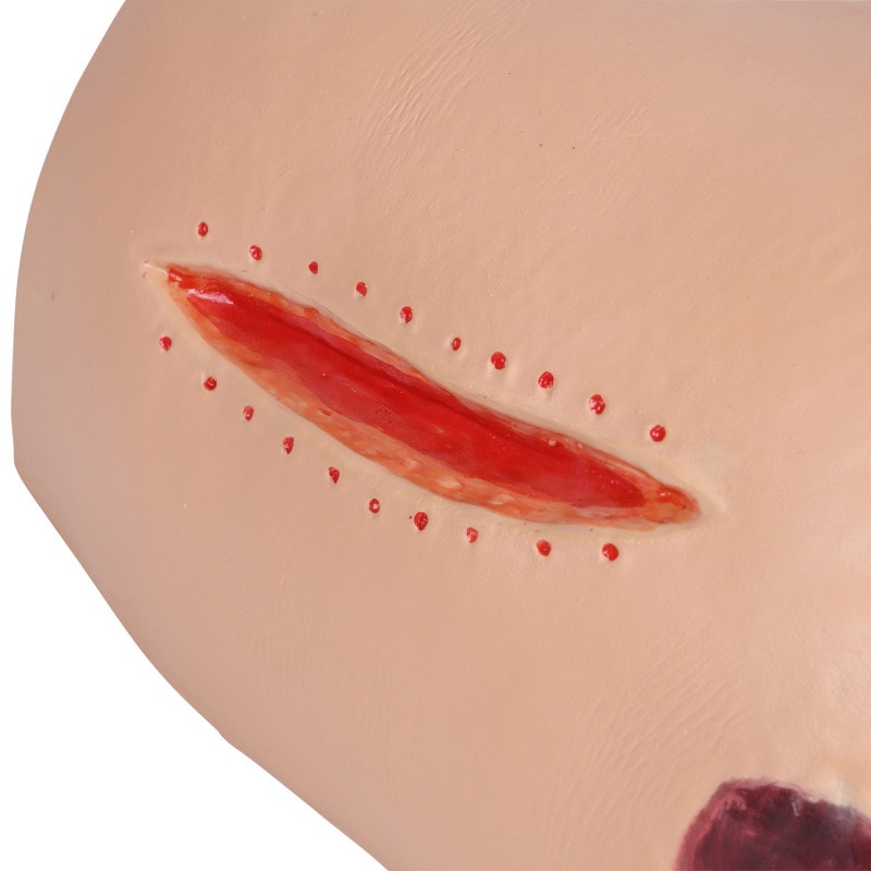 DECUBITUS DAN Treatment Simulator