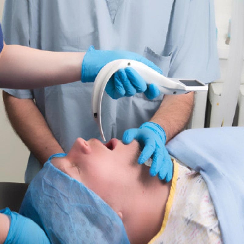 i-view Video Laryngoscope from Intersurgical