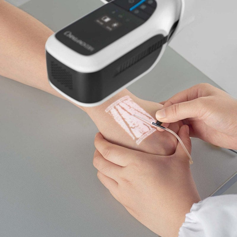 VeinNavi® Vein Finder NAVI-60