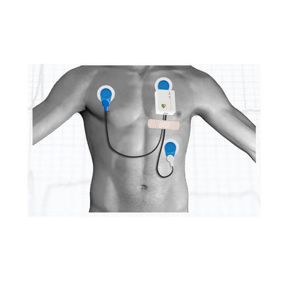 Kobold II Long-Term ECG Evaluation Package