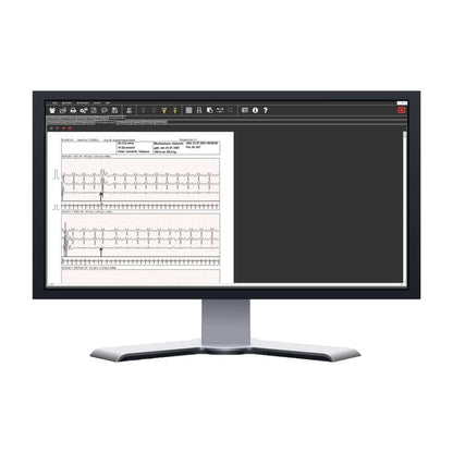 Kobold II Long-Term ECG Evaluation Package
