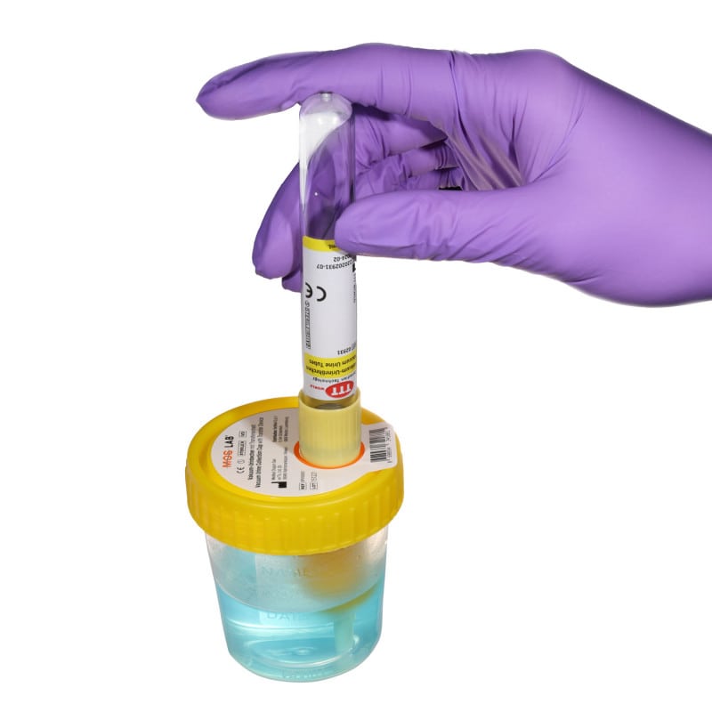 Vacuum Urine Tube