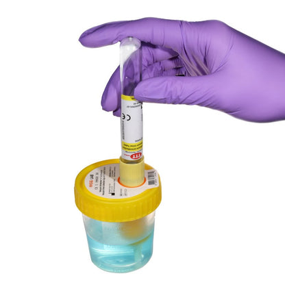 Vacuum Urine Tube