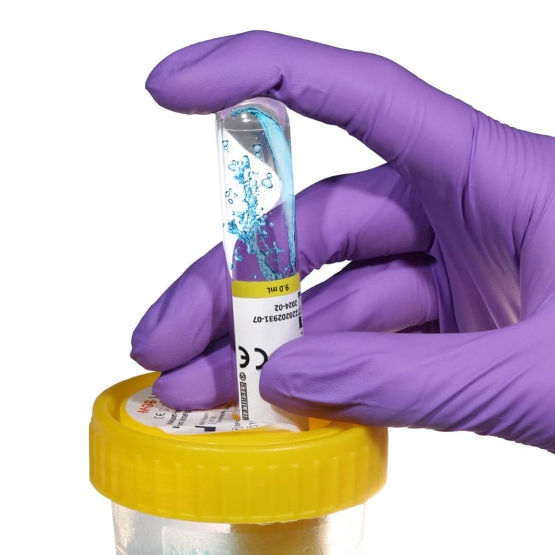 Vacuum Urine Tube