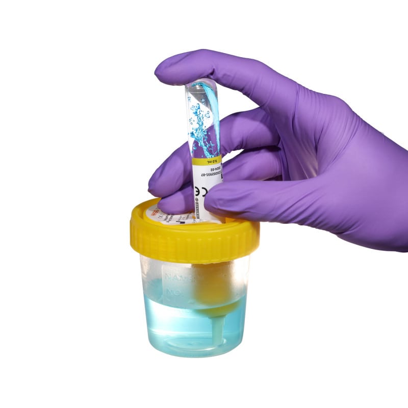 Vacuum Urine Tube