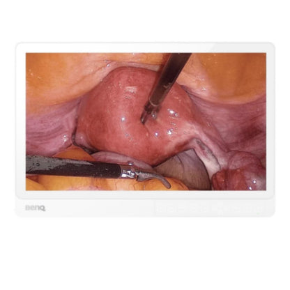 BenQ 21.5" Full HD Surgical Display