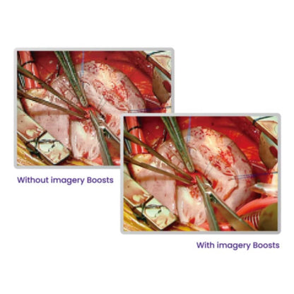 BenQ 27" High-Bright Full-HD Surgical Display