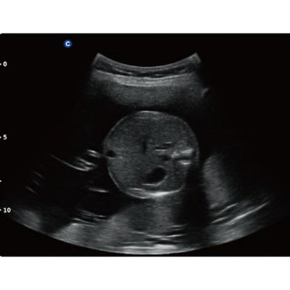 QBit 5 Ultrasound Machine without battery