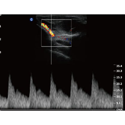 QBit 5 Ultrasound Machine without battery