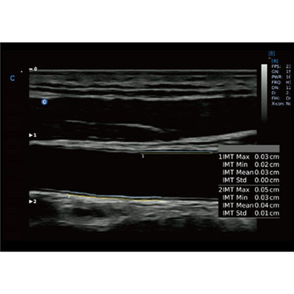 CBit6 Ultrasound Machine without battery
