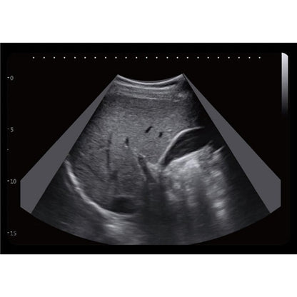 CBit6 Ultrasound Machine with battery