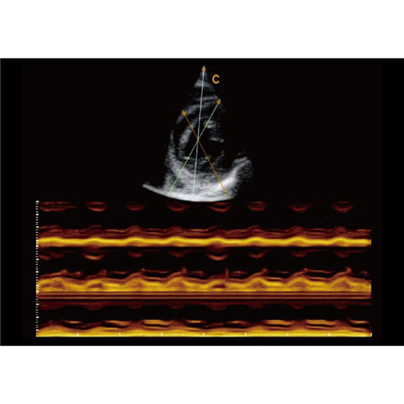 CBit6 Ultrasound Machine with battery