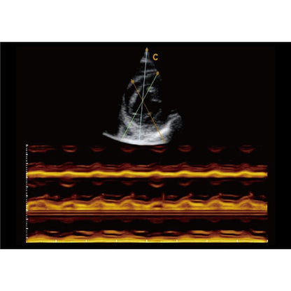 CBit6 Ultrasound Machine without battery