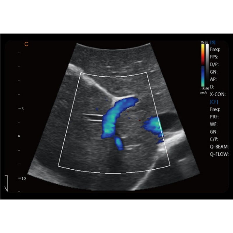 CBit6 Ultrasound Machine with battery