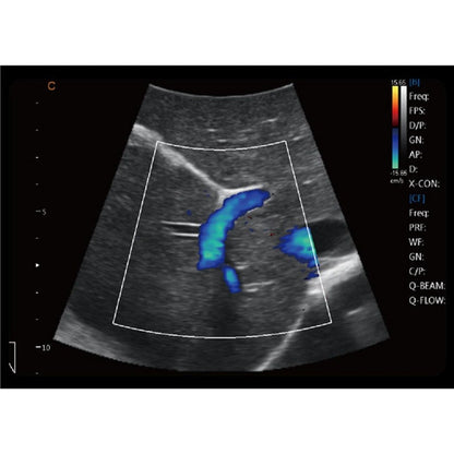 CBit6 Ultrasound Machine with battery