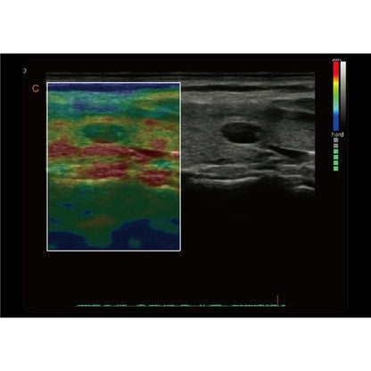 CBit6 Ultrasound Machine with battery