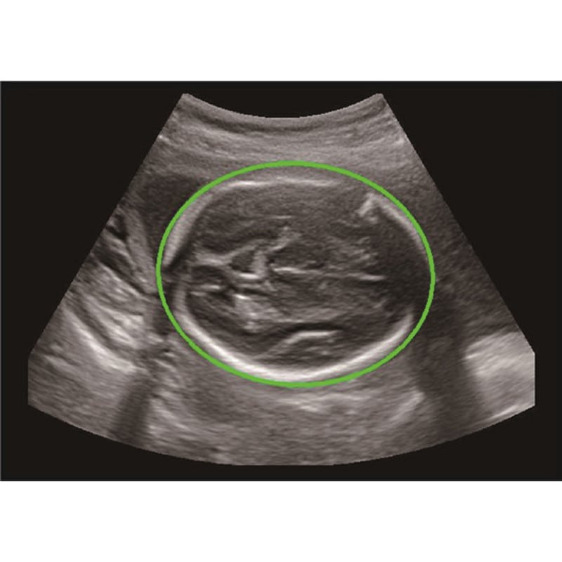 CBit6 Ultrasound Machine with battery