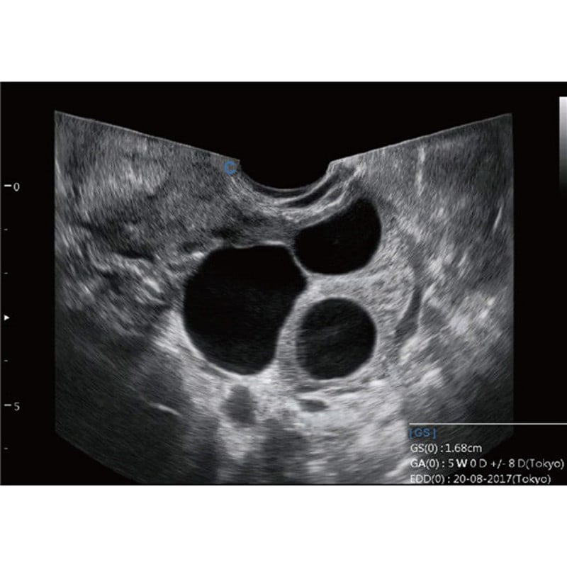 CBit6 Ultrasound Machine with battery