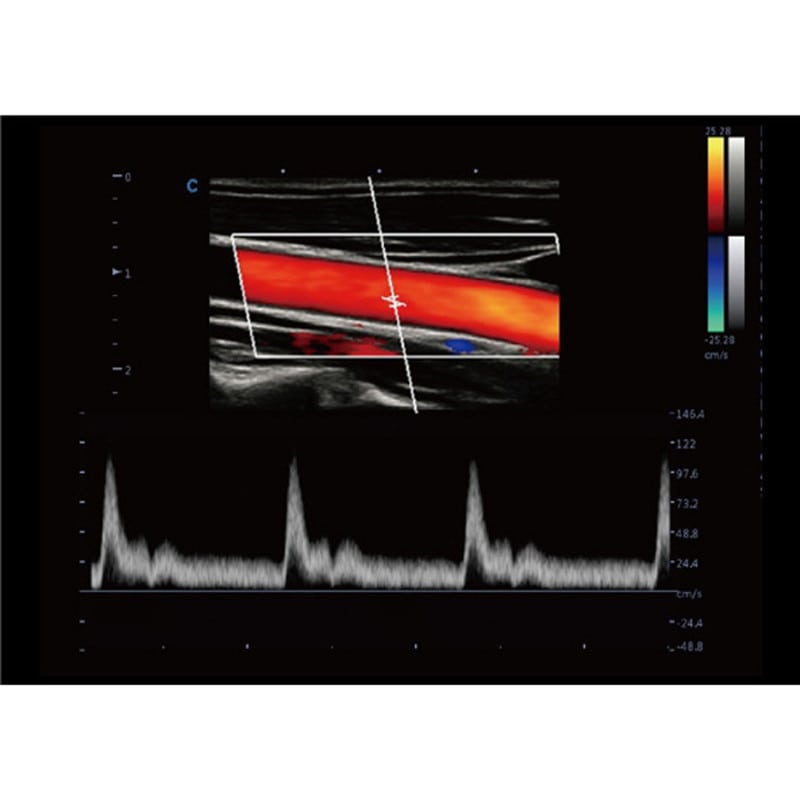 CBit 9 Color Doppler Ultrasound System without battery