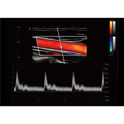 CBit 9 Color Doppler Ultrasound System without battery