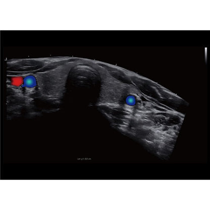 CBit 9 Color Doppler Ultrasound System with battery