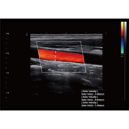 CBit 9 Color Doppler Ultrasound System with battery