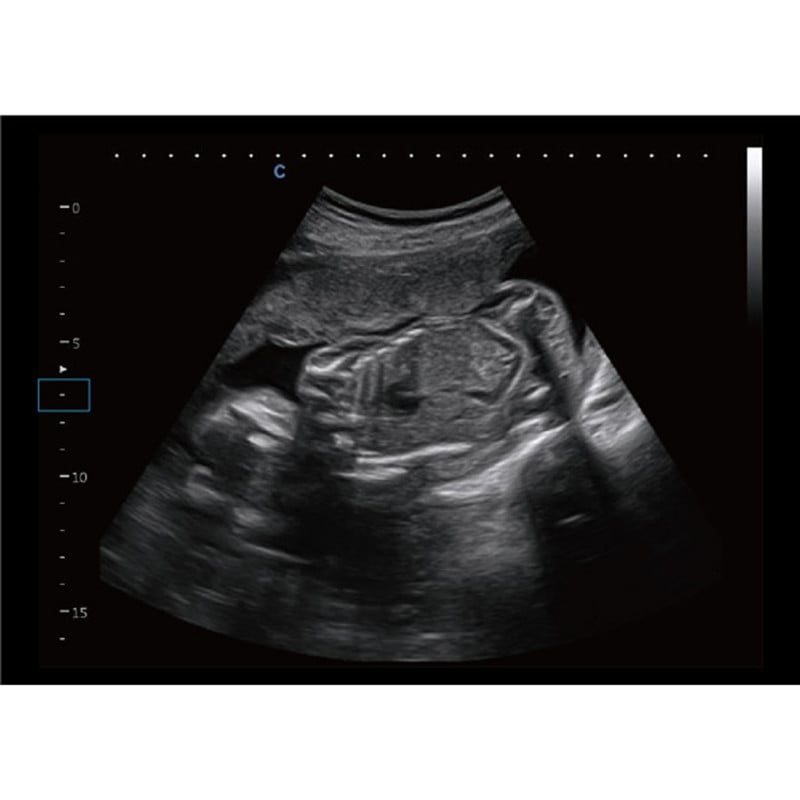 CBit 9 Color Doppler Ultrasound System with battery