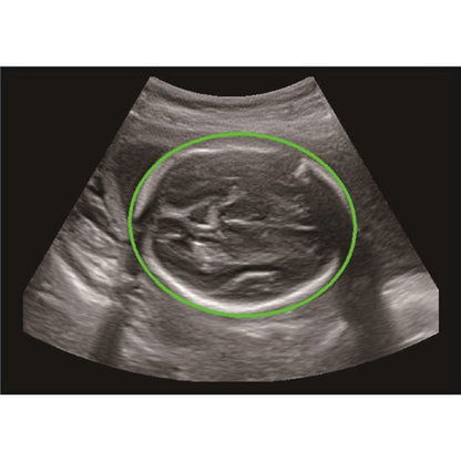 CBit 9 Color Doppler Ultrasound System with battery