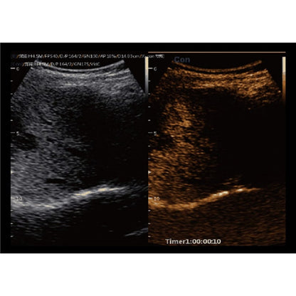CBit 9 Color Doppler Ultrasound System without battery