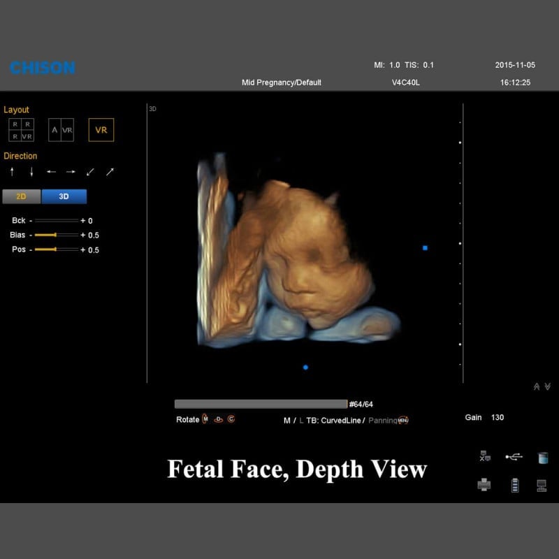 QBit 7 Ultrasound System