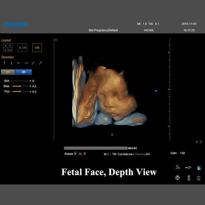 QBit 7 Ultrasound System