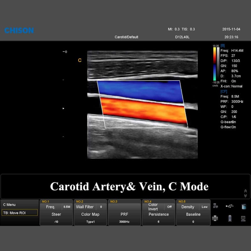 QBit 7 Ultrasound System