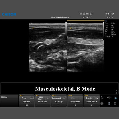 QBit 7 Ultrasound System