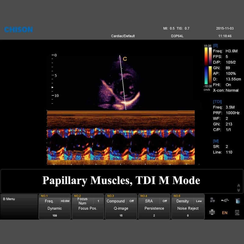 QBit 7 Ultrasound System