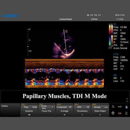 QBit 7 Ultrasound System