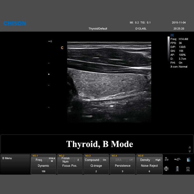 QBit 7 Ultrasound System