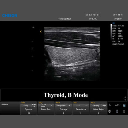 QBit 7 Ultrasound System