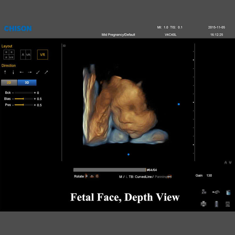 QBit 9 Ultrasound System