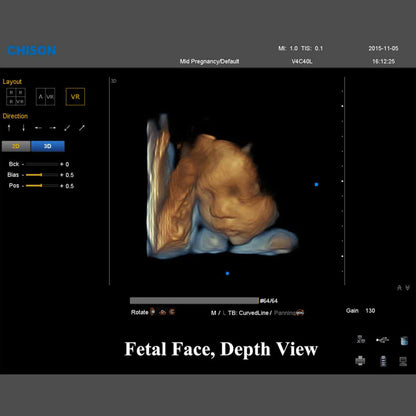 QBit 9 Ultrasound System