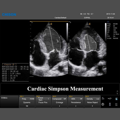 QBit 9 Ultrasound System