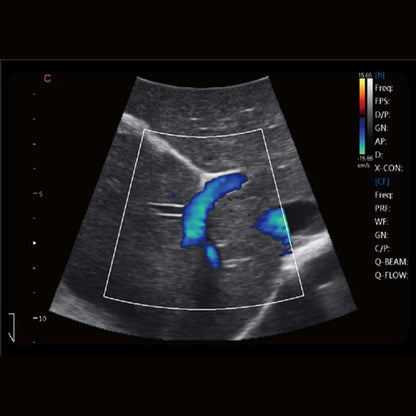 CBit 4 Ultrasound System