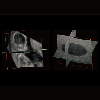 CBit 4 Ultrasound System