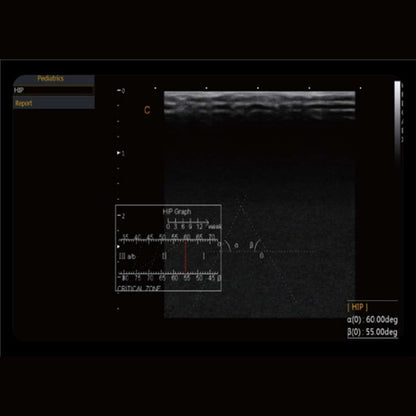 CBit 4 Ultrasound System